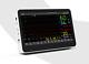 Cms8500 Portable 14 Touch Color Lcd Vital Signs Multi Parameter Patient Monitor